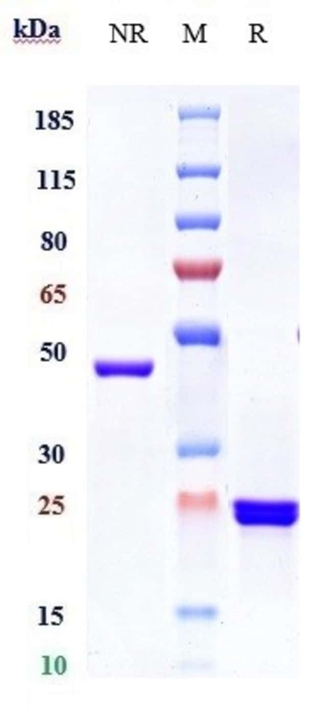 GLENZOCIMAB RMAB 1 MG