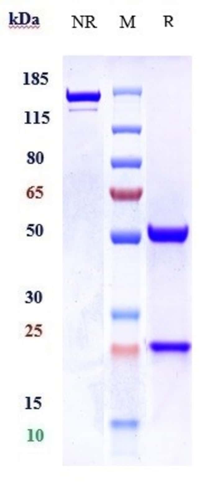 PCYT1B BIOSIMILAR RMAB 1 MG
