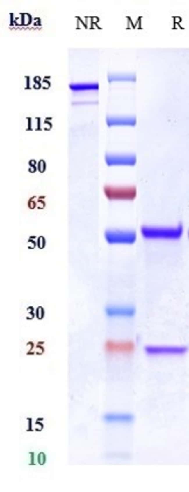 ERLIZUMAB RMAB 1 MG