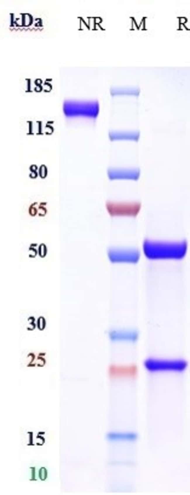 ALBUMIN BIOSIMILAR RMAB 1 MG
