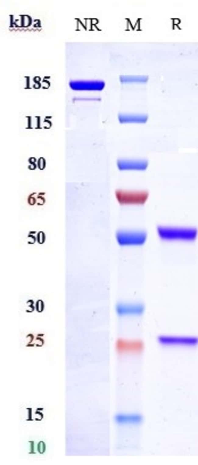 ENDOTHELIN B RECEPTOR BIO RMAB 100 UG