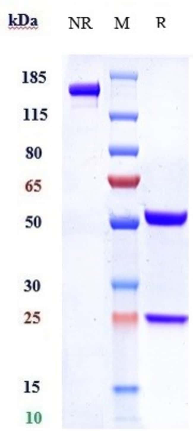 SLC44A4 BIOSIMILAR RMAB 1 MG