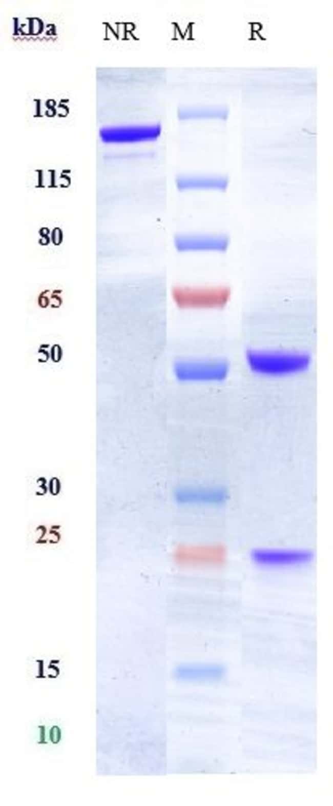 EPHRIN A4 BIOSIMILAR RMAB 1 MG