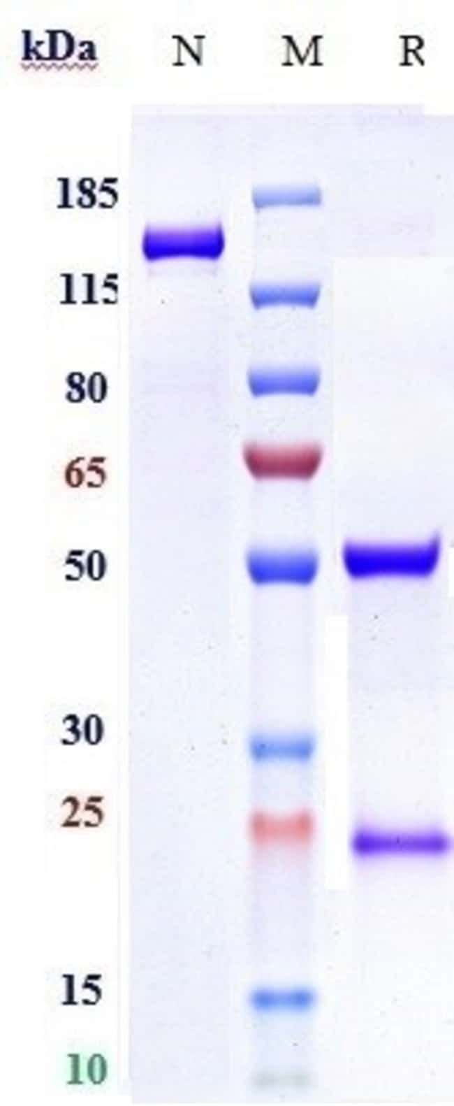 ZANSECIMAB RMAB 1 MG