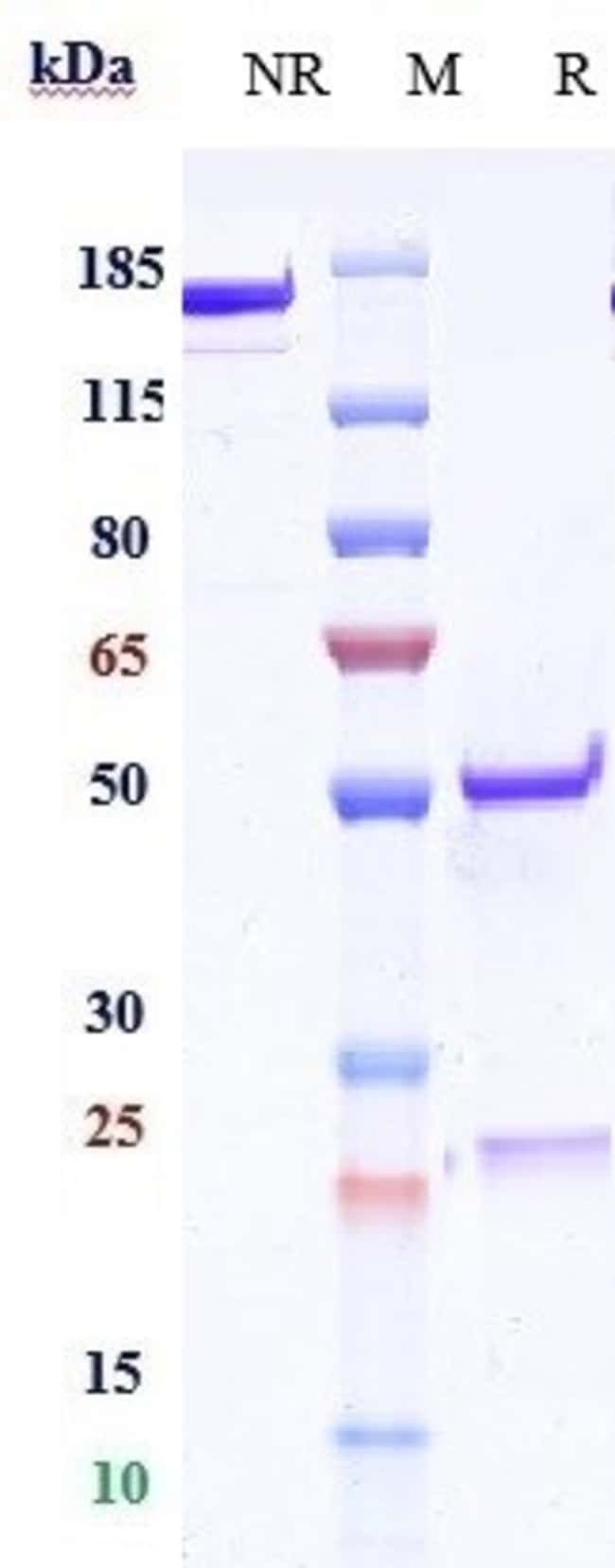 CD83 BIOSIMILAR RMAB 1 MG