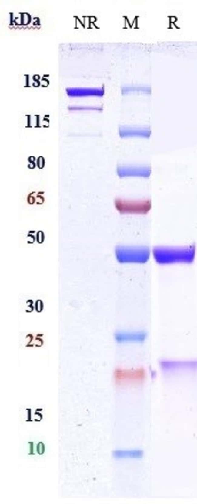 EBRONUCIMAB RMAB 1 MG