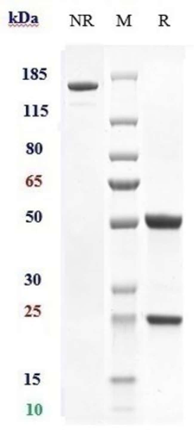 ETROLIZUMAB RMAB 1 MG