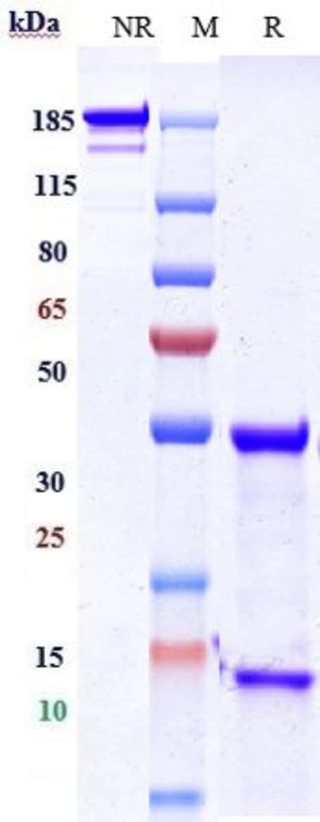 MATUZUMAB RMAB 1 MG