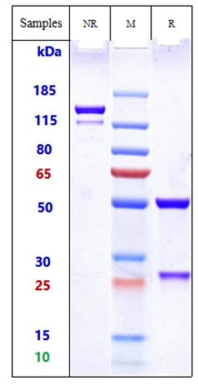 HERSINTUZUMAB RMAB 1 MG