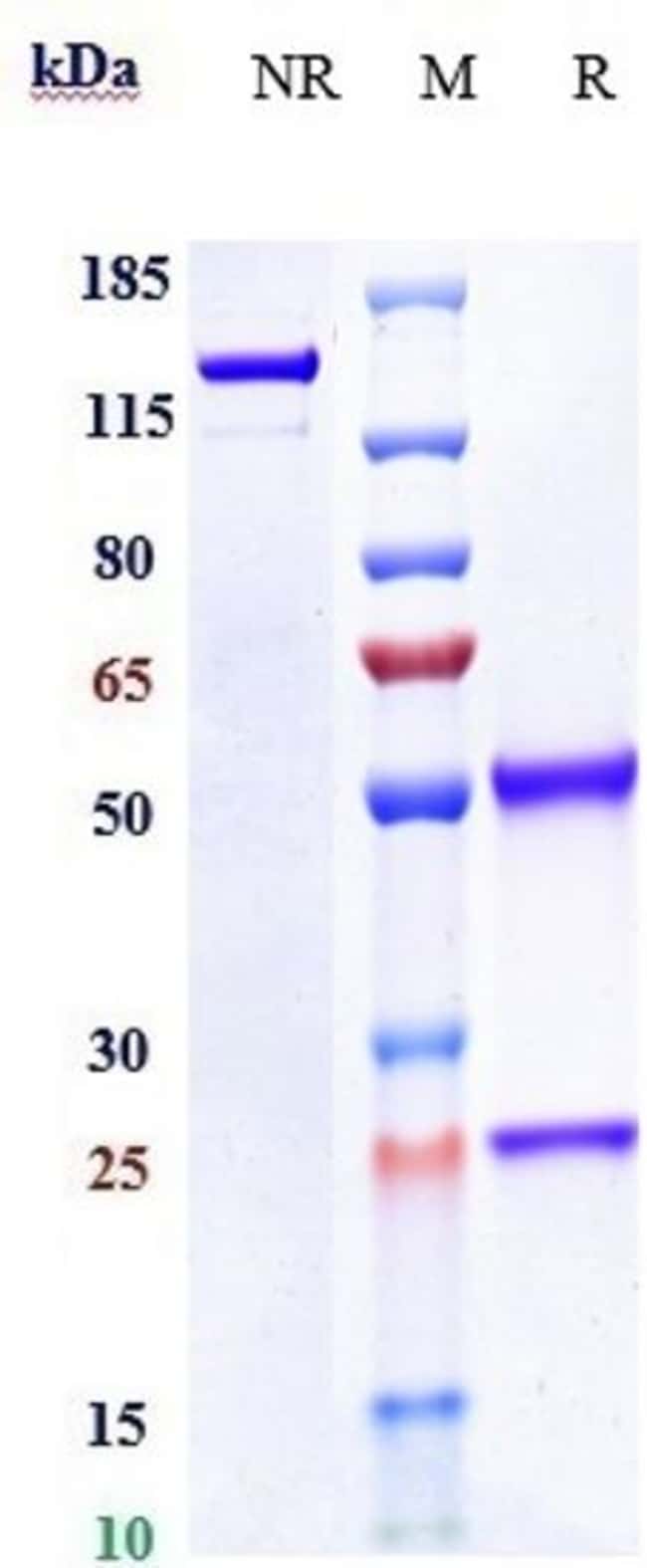 MCK10 BIOSIMILAR RMAB 1 MG