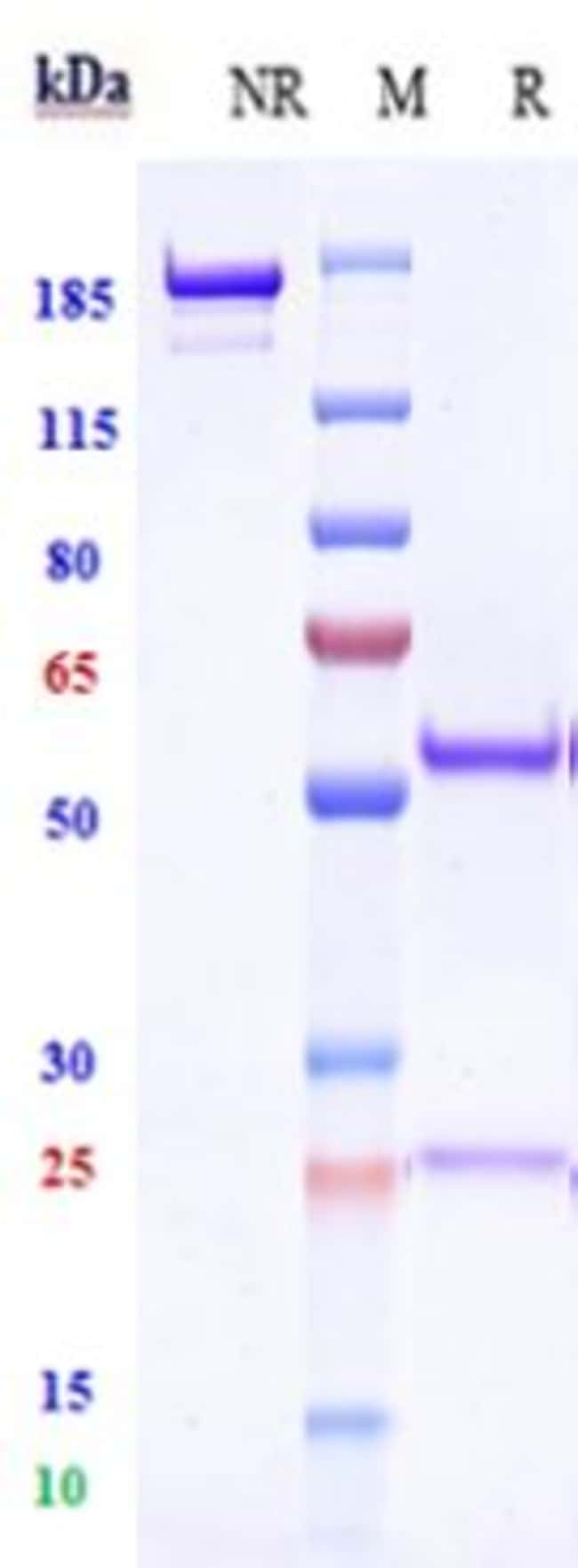 IVUXOLIMAB RMAB 1 MG