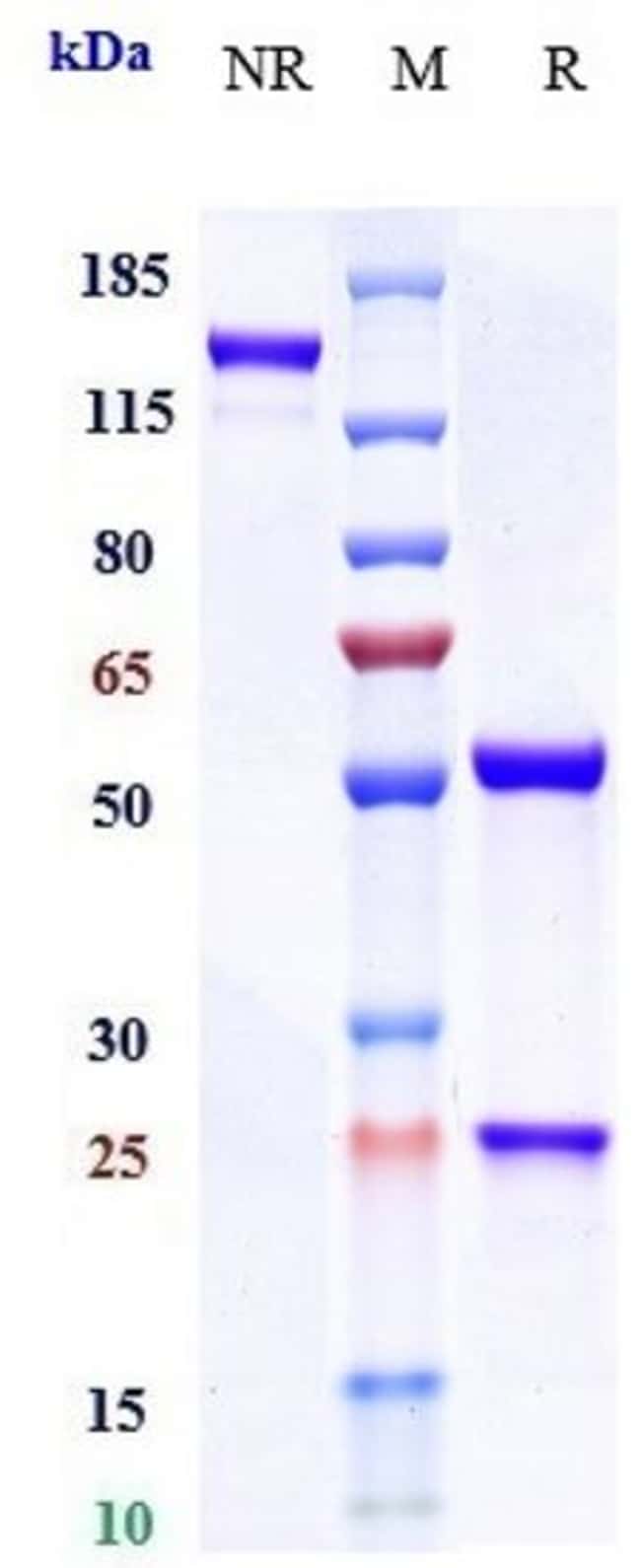 MIRIKIZUMAB RMAB 1 MG