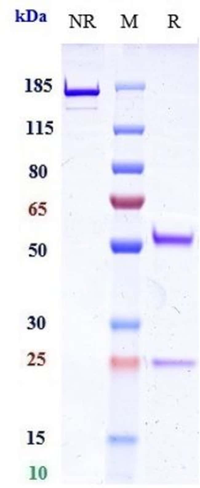 ONGERICIMAB RMAB 1 MG