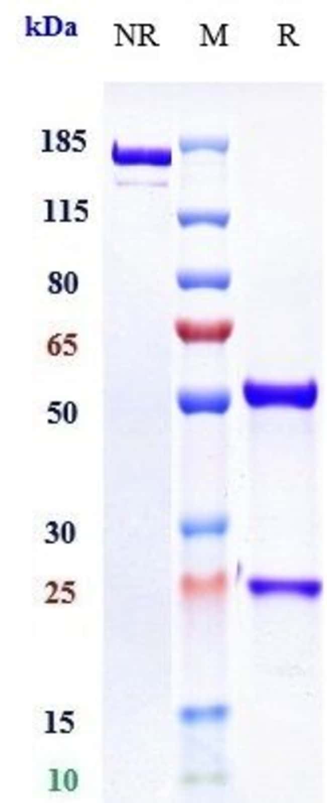 OSOCIMAB RMAB 1 MG