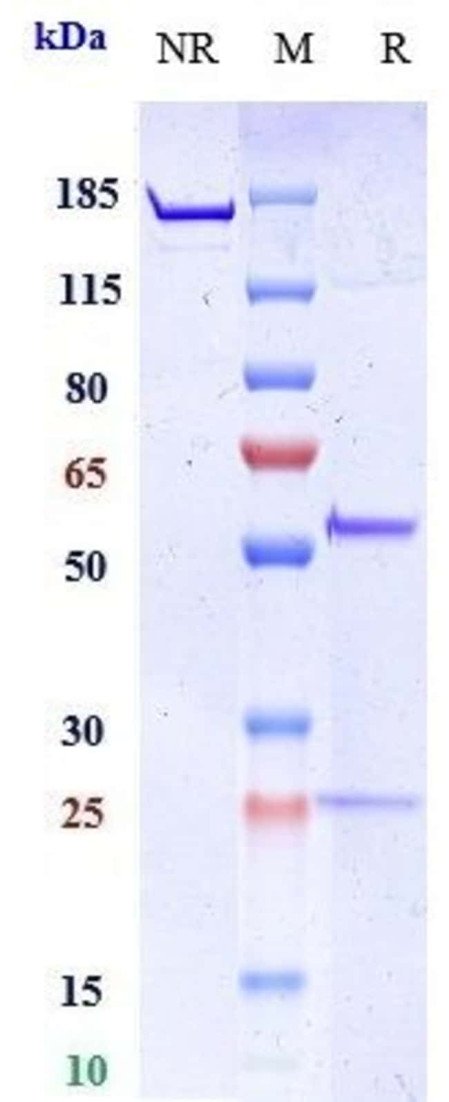 MMP-9 BIOSIMILAR RMAB 1 MG