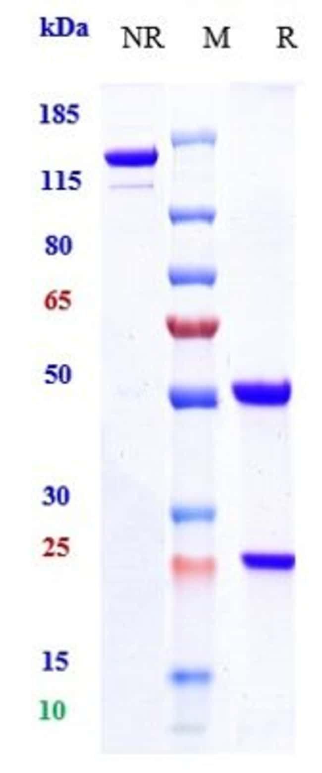 CD20 BIOSIMILAR RMAB 1 MG