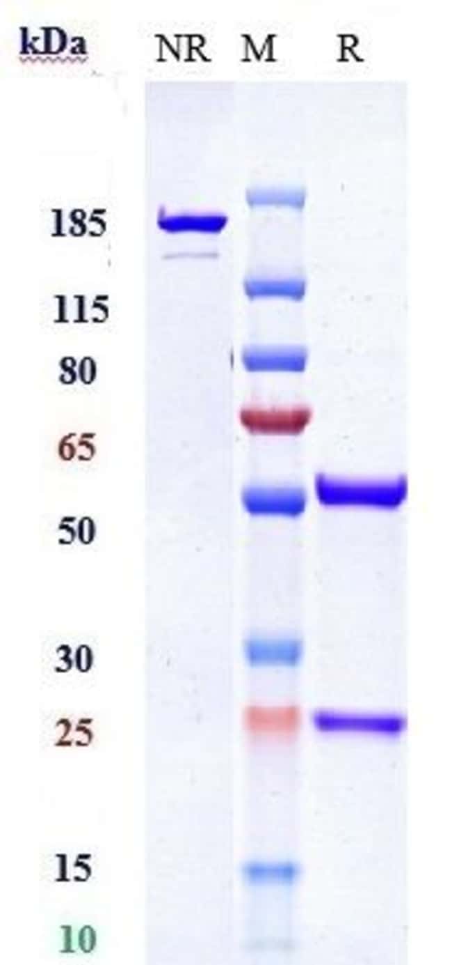 PDGFRB (CD140B) BIOSIMILA RMAB 100 UG