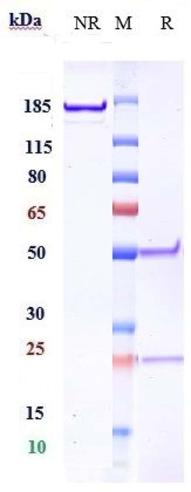 ROBATUMUMAB RMAB 1 MG