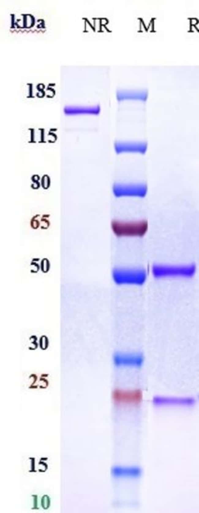 SIGLEC15 BIOSIMILAR RMAB 1 MG
