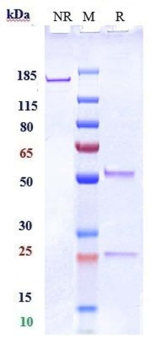 SIGLEC15 BIOSIMILAR RMAB 1 MG