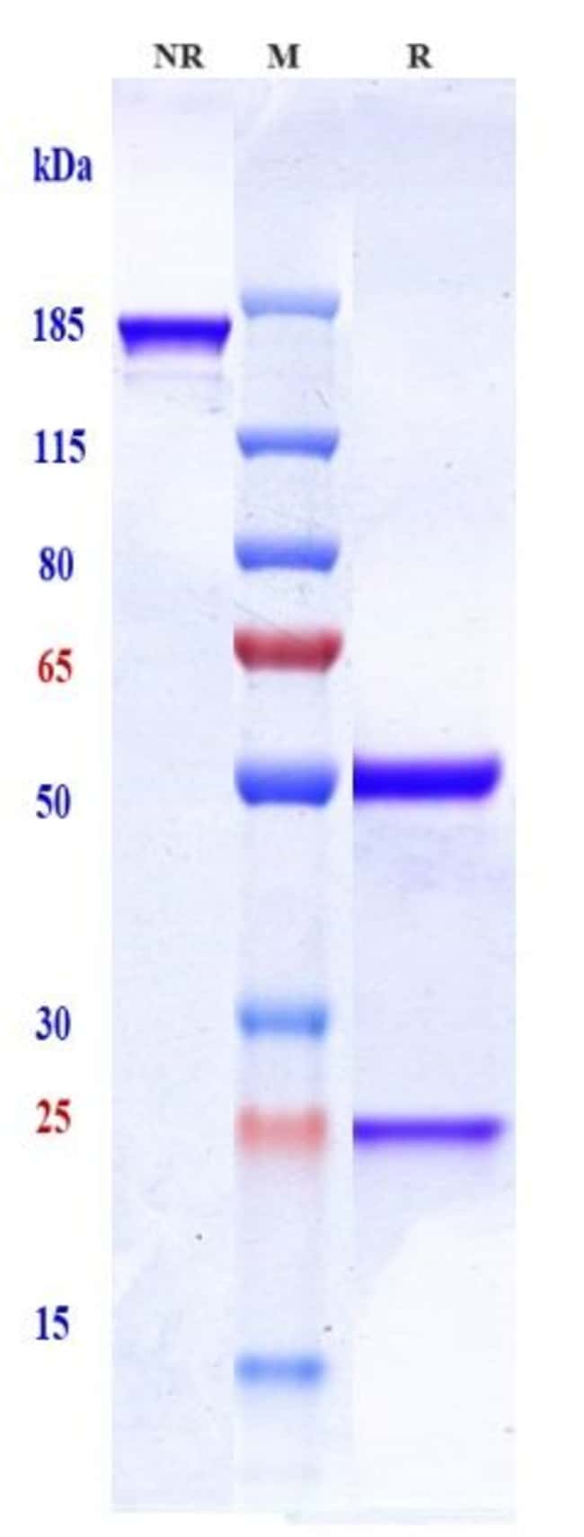 SONEPCIZUMAB RMAB 1 MG