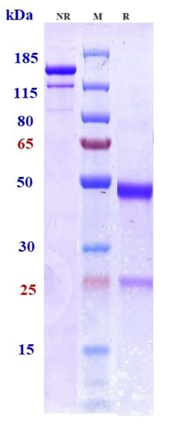 BEPRANEMAB RMAB 1 MG