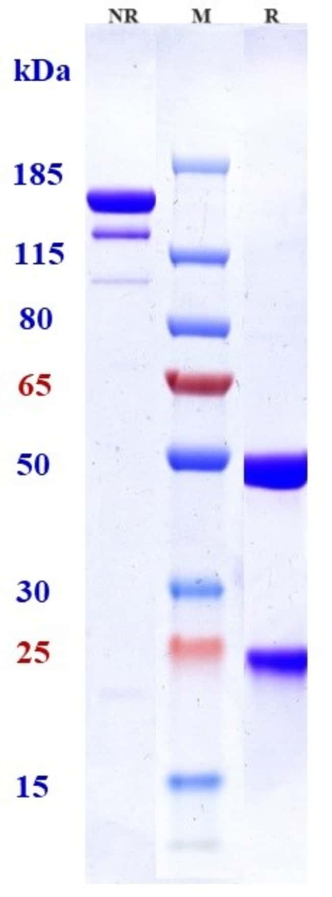 TESIDOLUMAB RMAB 1 MG