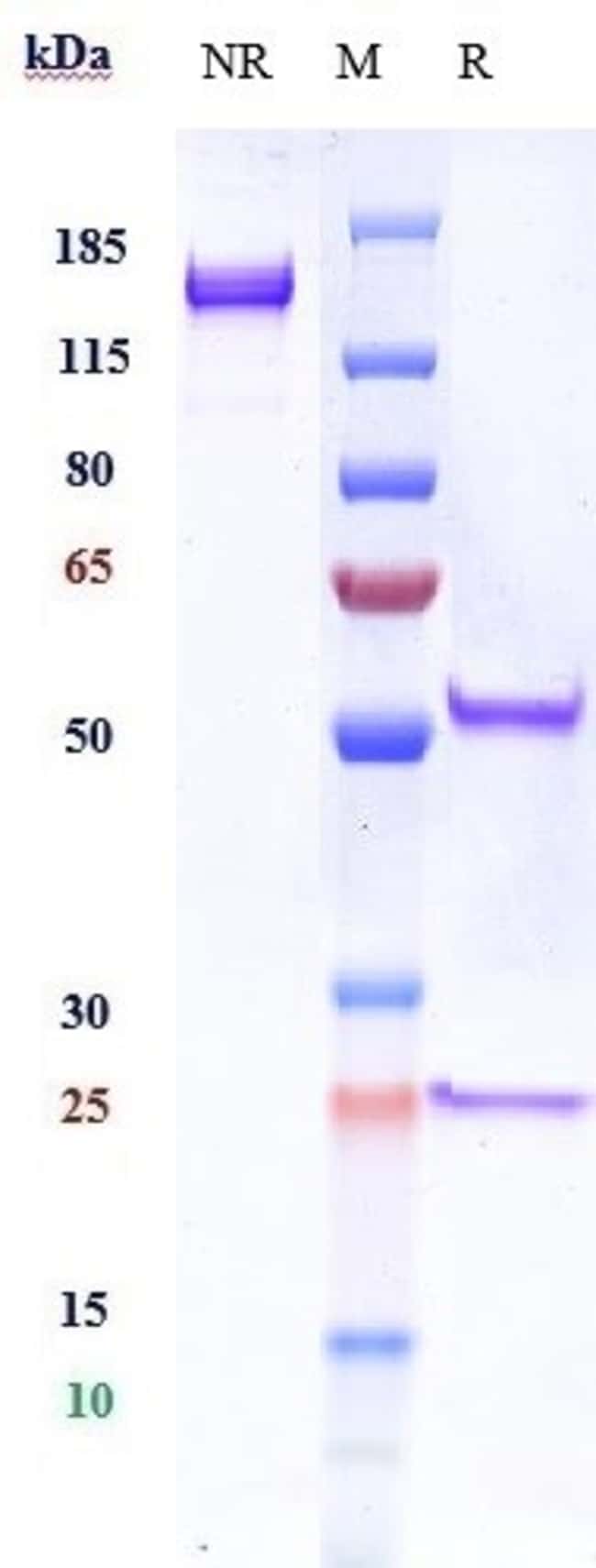 TRKB BIOSIMILAR RMAB 1 MG