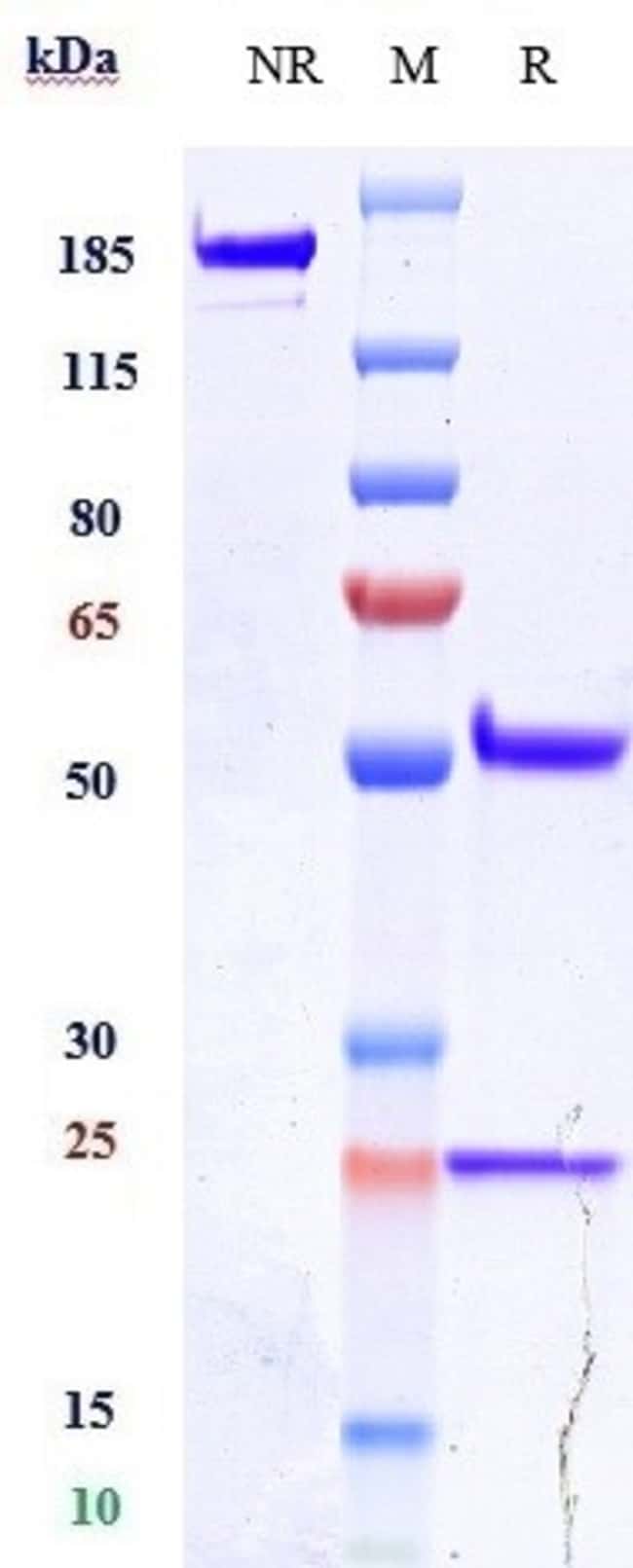ALACIZUMAB RMAB 1 MG