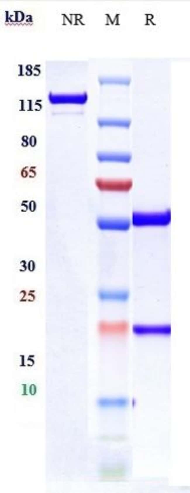 CD203C BIOSIMILAR RMAB 1 MG