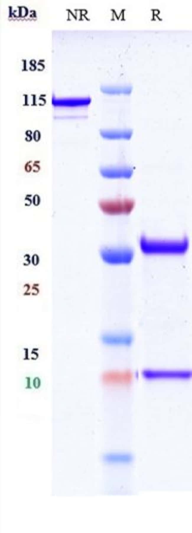 CD36 BIOSIMILAR RMAB 1 MG
