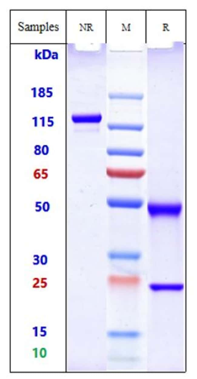 PLACENTAL ALKALINE PHOSPH RMAB 100 UG