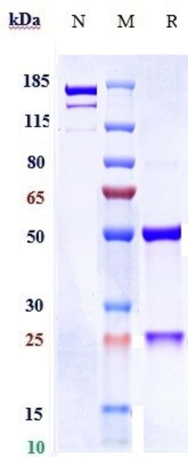 OST 577 RMAB 1 MG