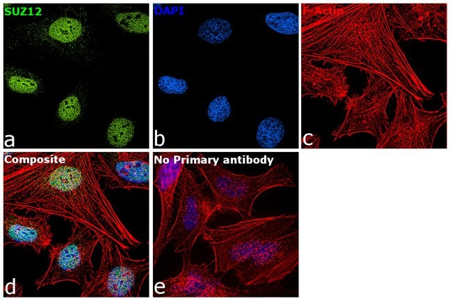 Anti-SUZ12 Antibody, 100µL ChIP assay di