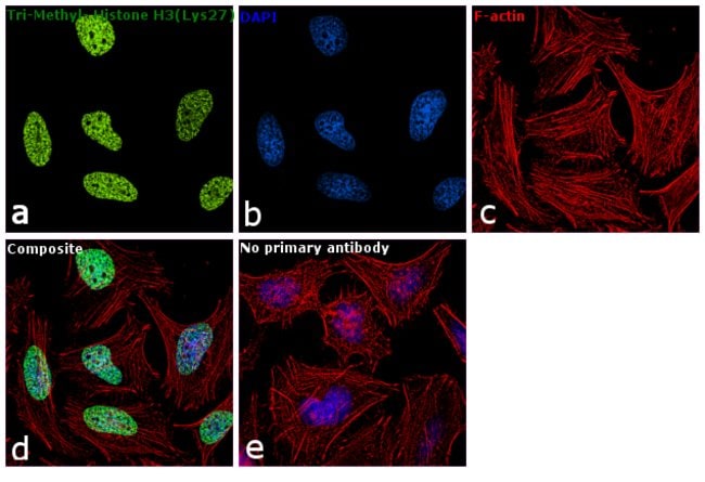 Anti-Tri-Methyl-Histone H3 Lys27 Antibod
