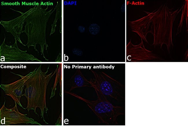 Actin Smooth Muscle (1A4 (asm-1)) Mouse