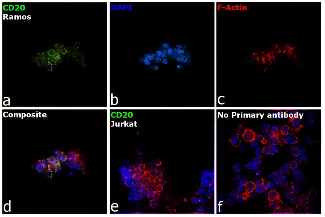 500 UL CD20 (L26) Ms mAb