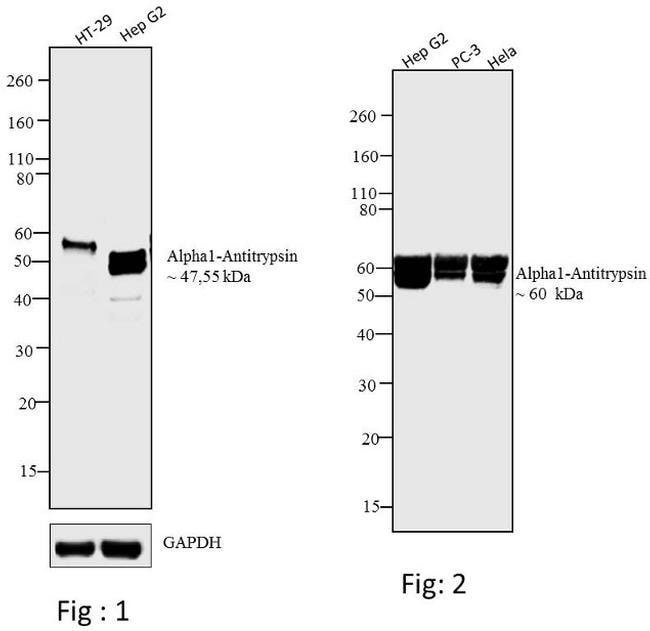 Alpha1-Antitrypsin Monoclonal  Antibody