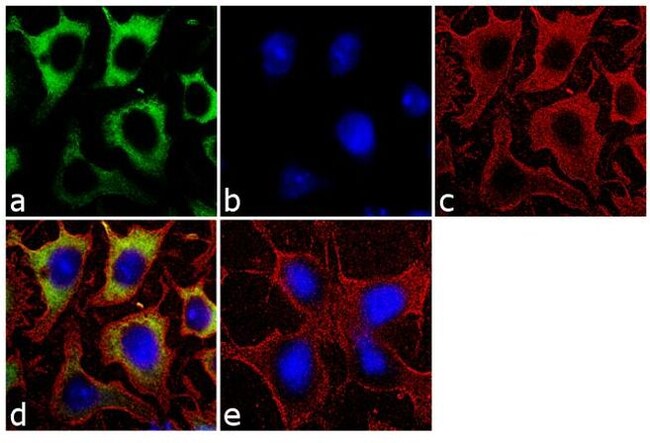 Alkaline Phosphatase Monoclonal Antib. 1