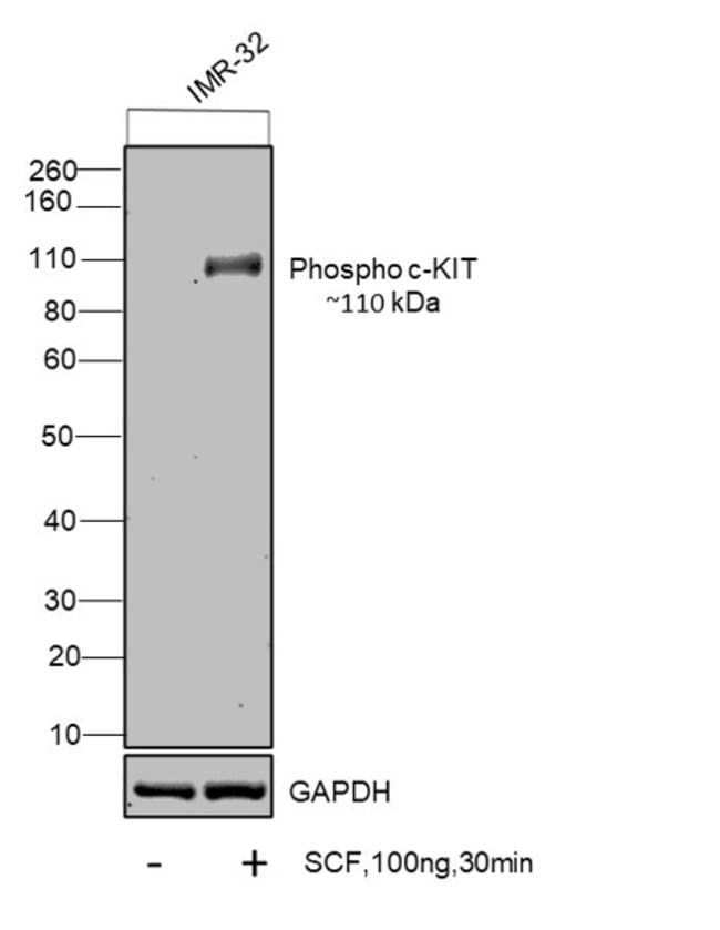 100UL PHOSPHO-C-KIT (TYR703) .