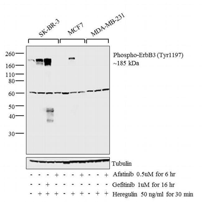100UL PHOSPHO-HER3/ERBB3 (TYR1197) .