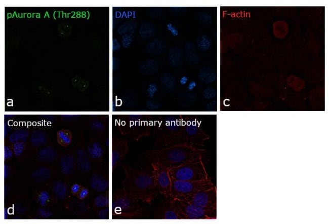 100UL PHOSPHO-AURORA A (THR288) .