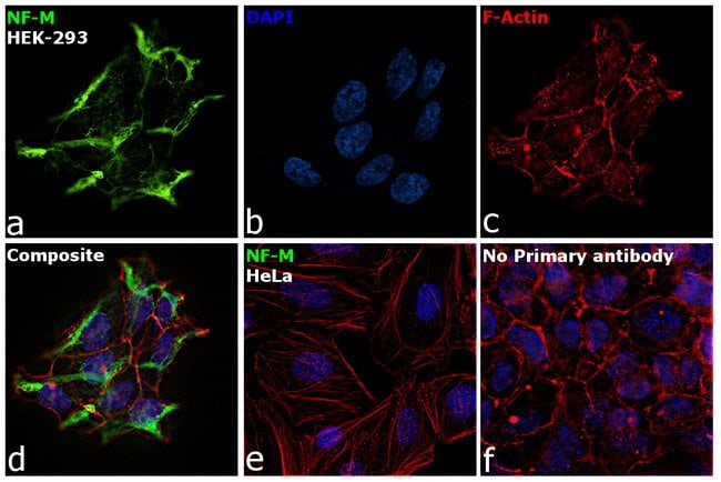 ANTI-NEUROFILAMENT-L MAB (T.400.5)