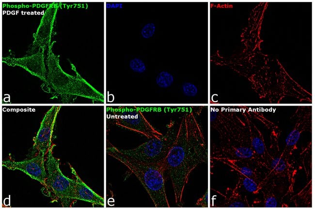 Antibody Phospho-PDGF Receptor beta (Tyr