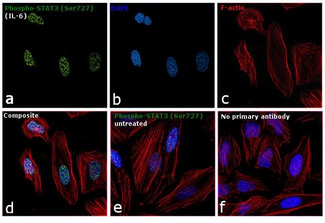 100UL PHOSPHO-STAT3 (SER727) .