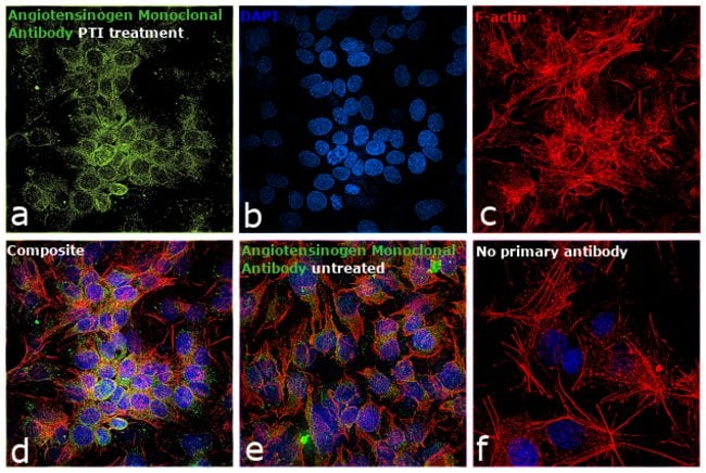 AGT Monoclonal Antibody 100 µl µL