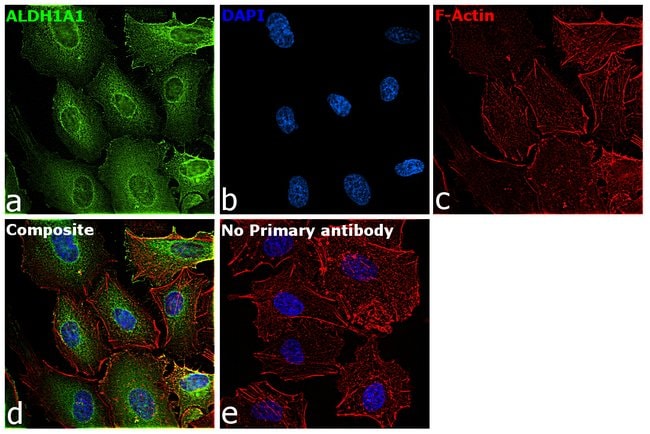 ALDH1A1 Monoclonal Antibody 100 µl