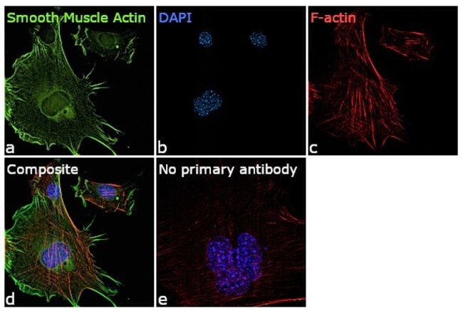 ACTA2 Monoclonal Antibody (1H8), 100 µl