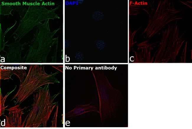ACTA2 Monoclonal Antibody (4A4), 100 µl