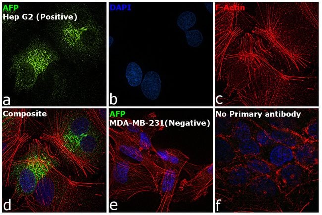 Anti-Alpha-Fetoprotein